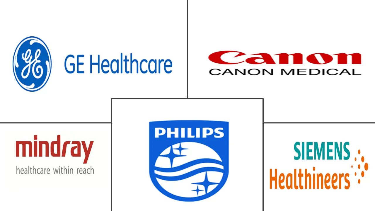 超声设备市场规模和份额