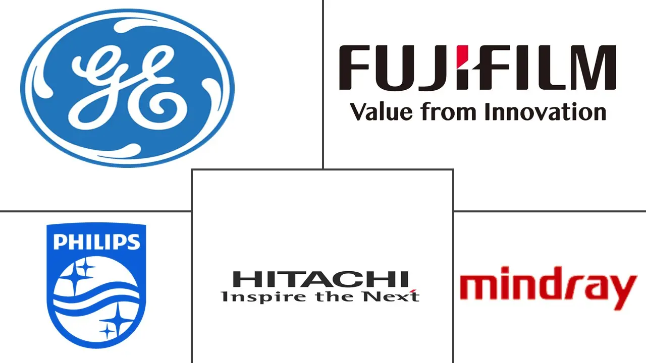 北美超声设备市场规模