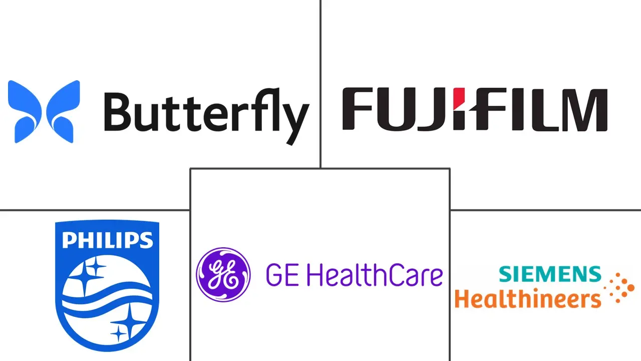 床旁超声市场规模和份额