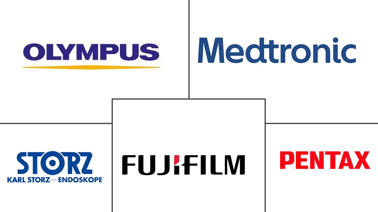 人工智能在内窥镜市场规模和份额