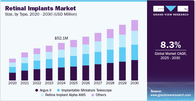 视网膜植入市场（2025 - 2030）