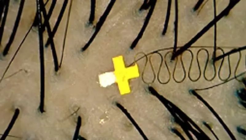 微型脑机接口问世：能置于毛囊间读数据(图1)