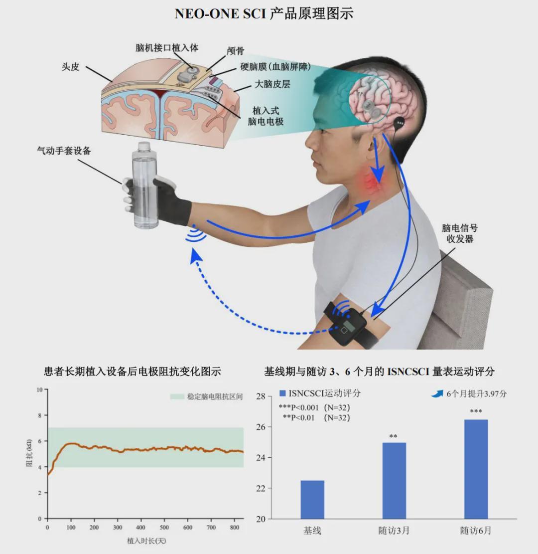 招股书里的博睿康：年入过亿仍亏2.3亿，脑机接口还要过商业化关(图7)